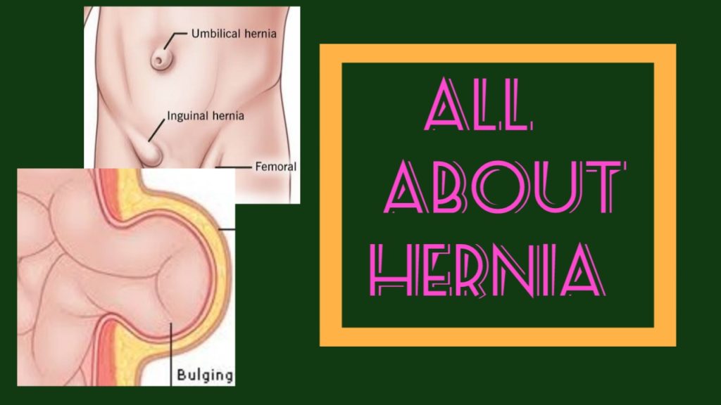 waht is hernia in hindi