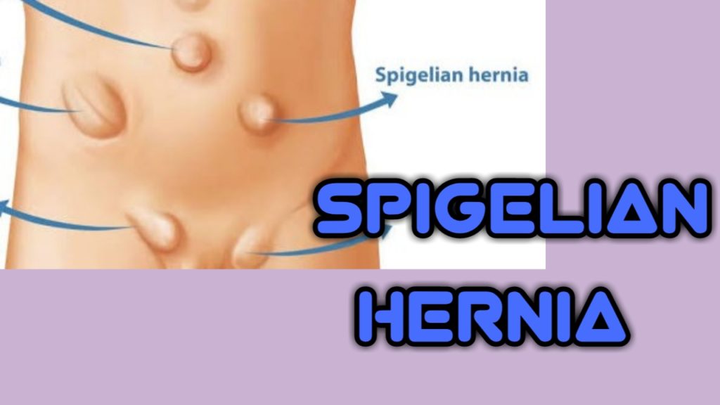 Types of hernia