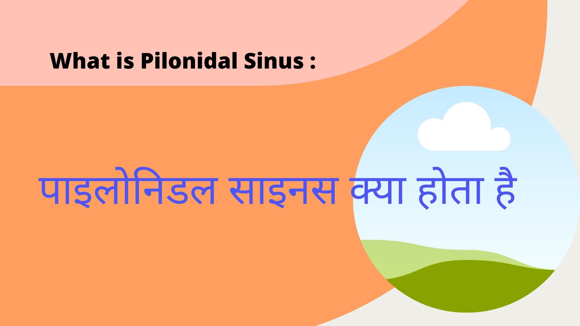 what is pilonidal sinus