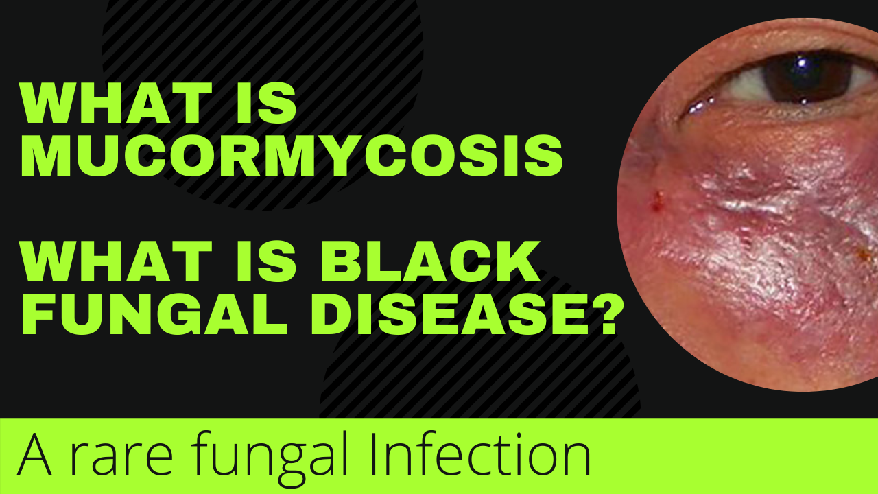 Mucormycosis infection, black fungal disease