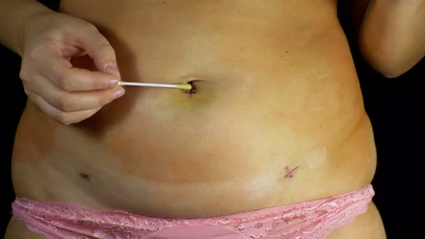 laparoscopy surgery