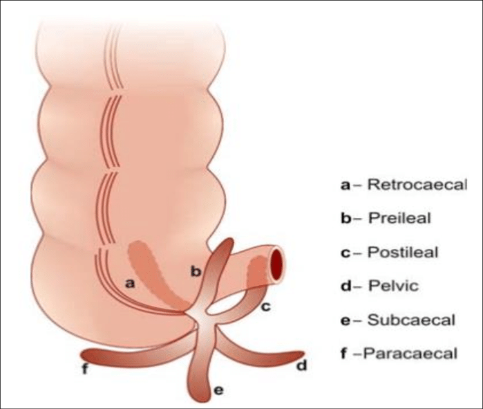 psitions of appendix