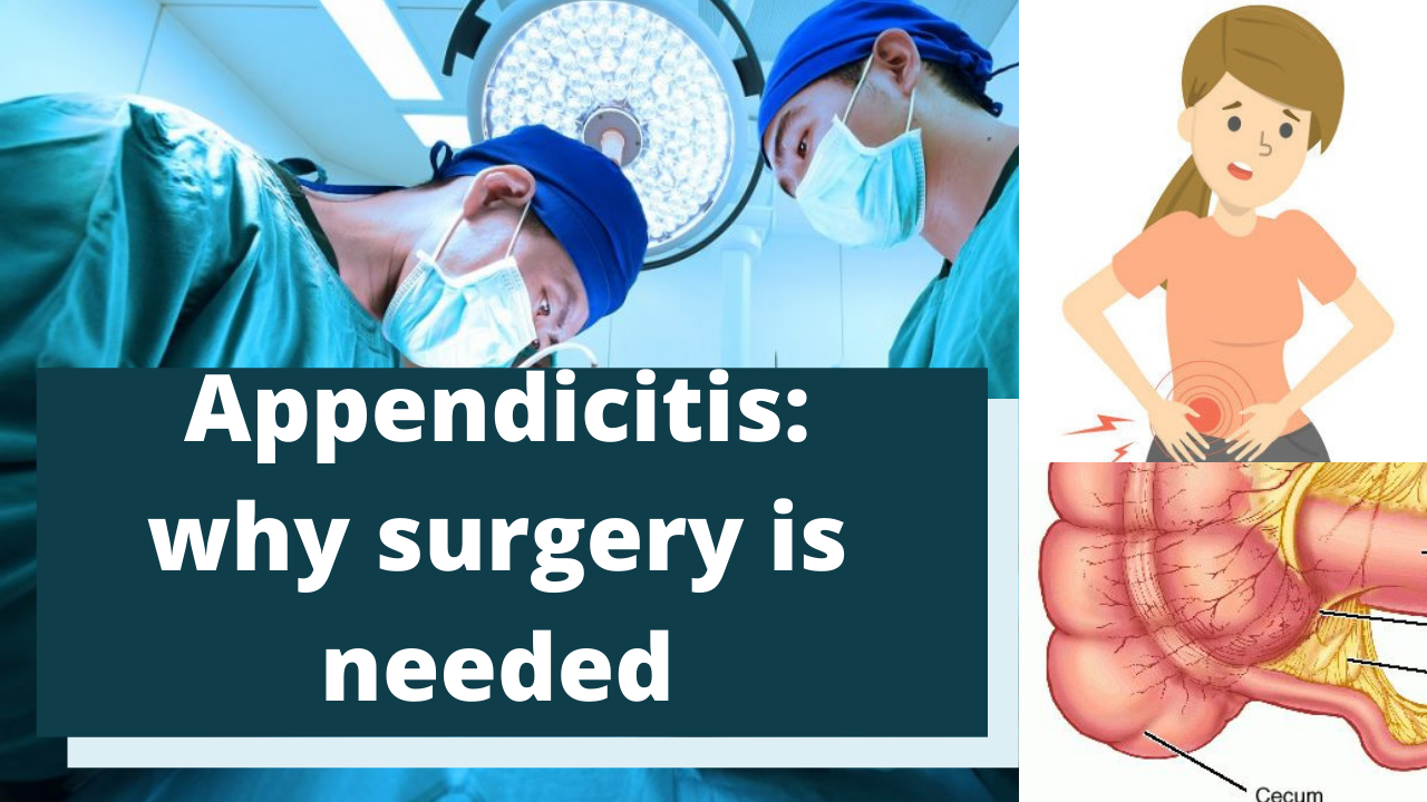 acute appendicitis