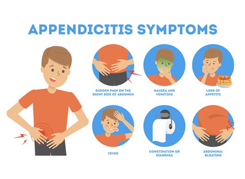 acute appendicitis symptoms