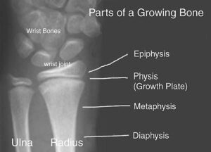 bone growth